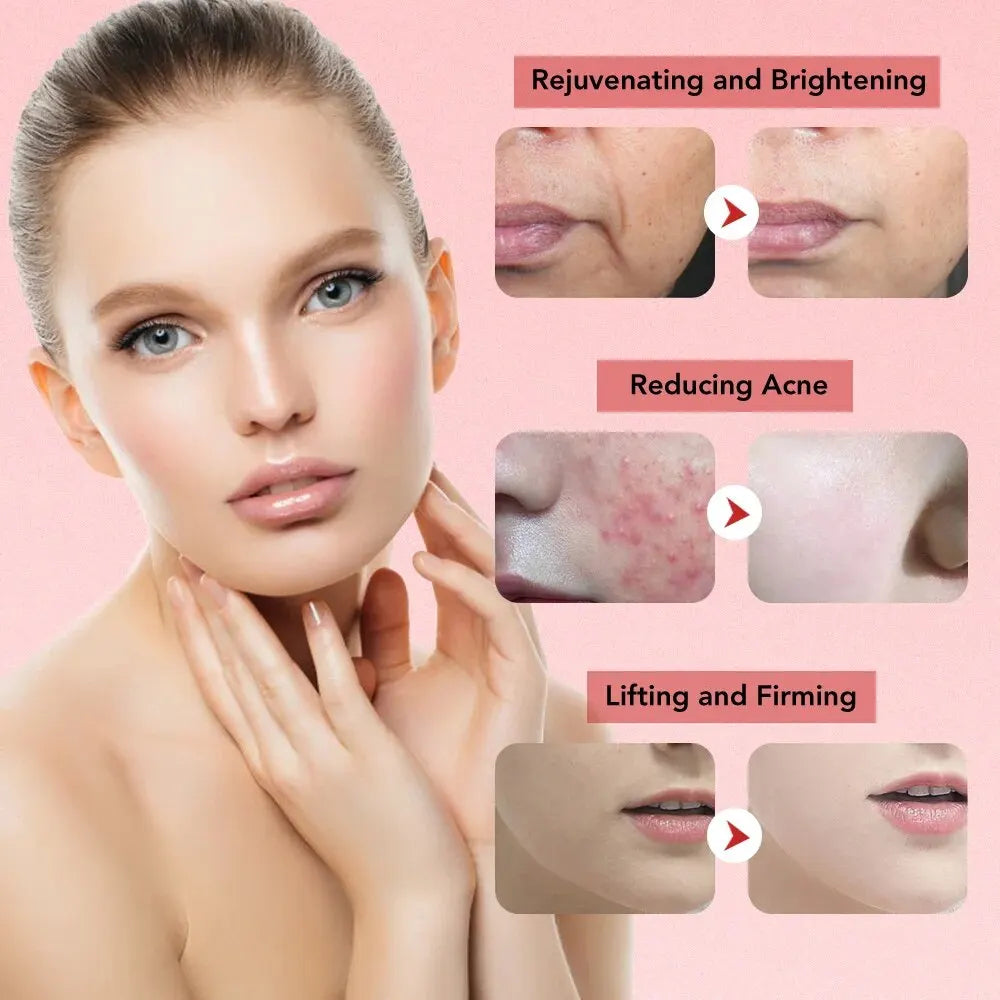 Radiance | 7-in-1 Gezichtsverjongingsapparaat